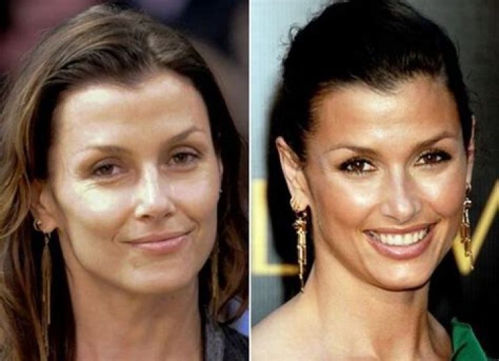 Bridget Moynahan Plastic Surgery Before and After