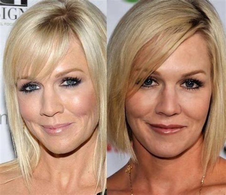 Jennie Garth Plastic Surgery Before and After
