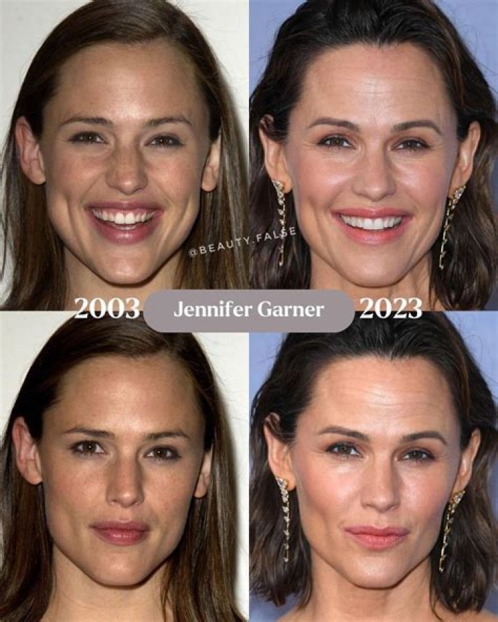 Jennifer Garner Plastic Surgery Before and After