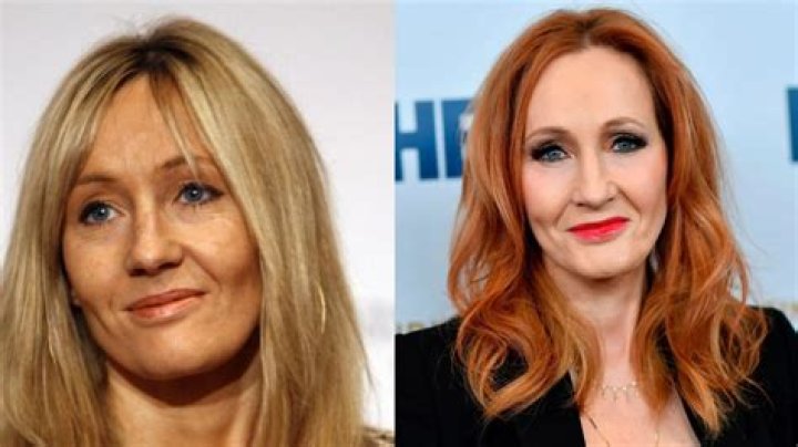 JK Rowling Facelift Plastic Surgery Before and After