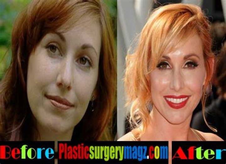 Kari Byron Breast Implants Plastic Surgery Before and After