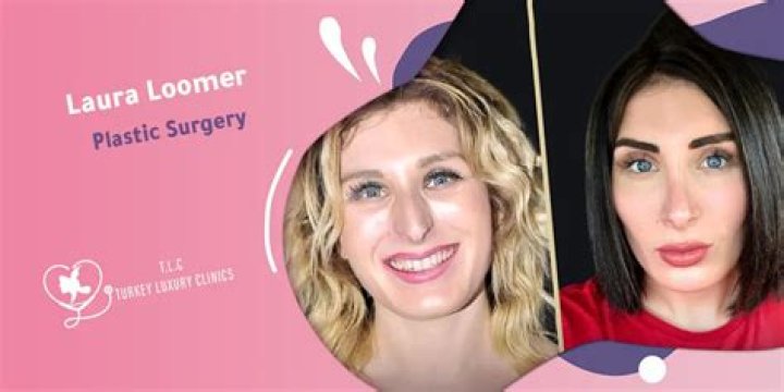 Laura Loomer Plastic Surgery: Exploring the Cause of Completely Different Appearance!