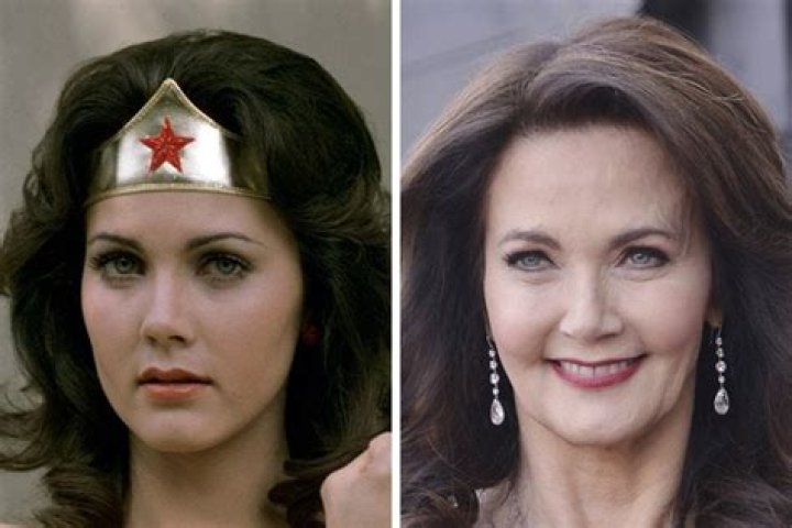 Lynda Carter Plastic Surgery: Delving Into the Truth Behind the Speculations