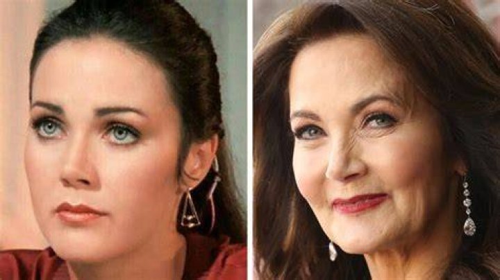Lynda Carter plastic surgery